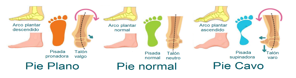 www.fisioterapia-online.com/pie-plano-que-es-causas-sintomas-diagnostico-tratamiento